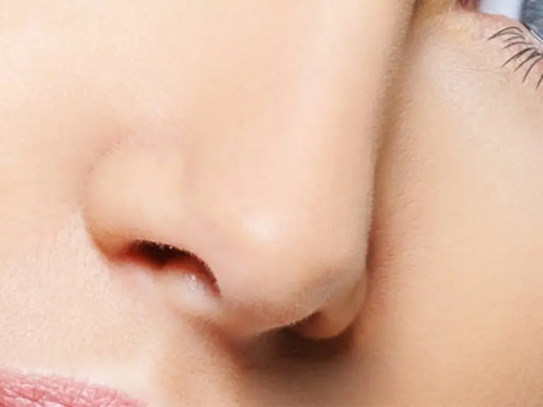 rhinoplasty Barrington, IL