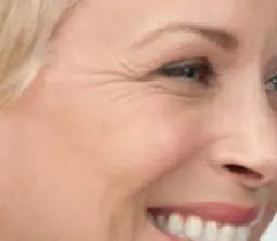 NEUROMODULATION BOTOX Right before