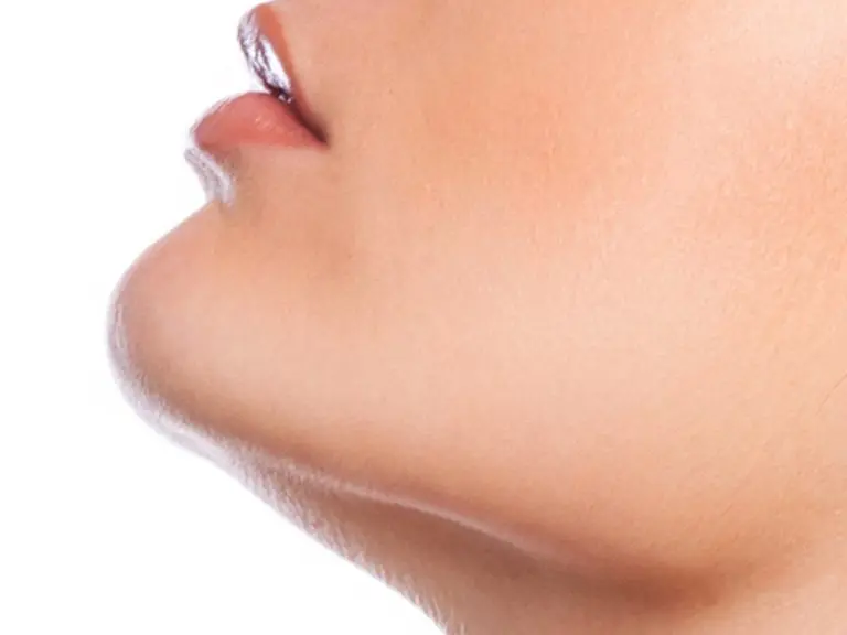 chin cheek implants Barrington, IL
