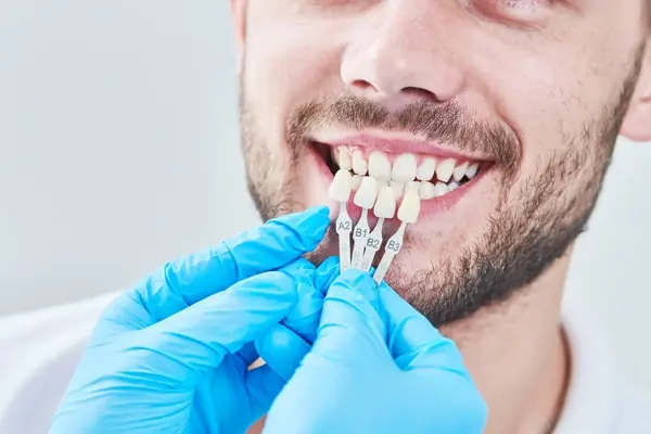 dental bonding