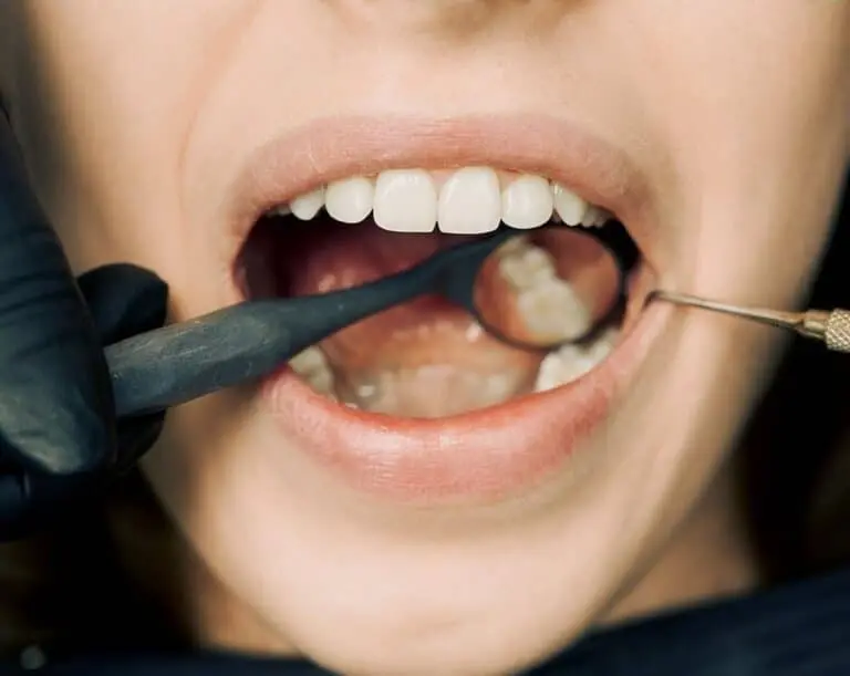 When Would You Need a Dental Crown? 9 Dentist checking inside a patient's mouth with mirror and scaler.