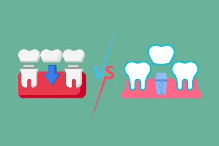 Illustration comparing dental implant and natural tooth structure.