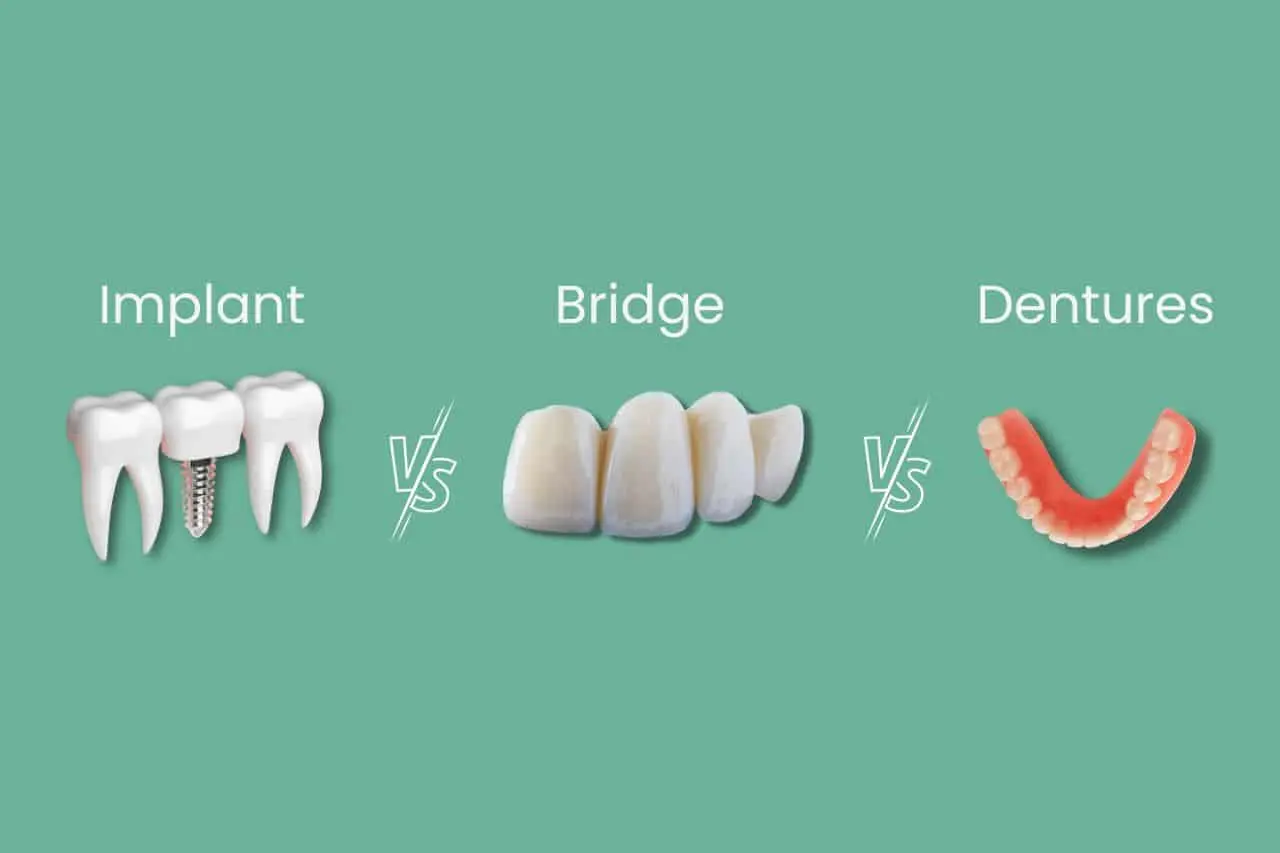 Graphic showing implant, bridge, and denture as tooth replacement options.