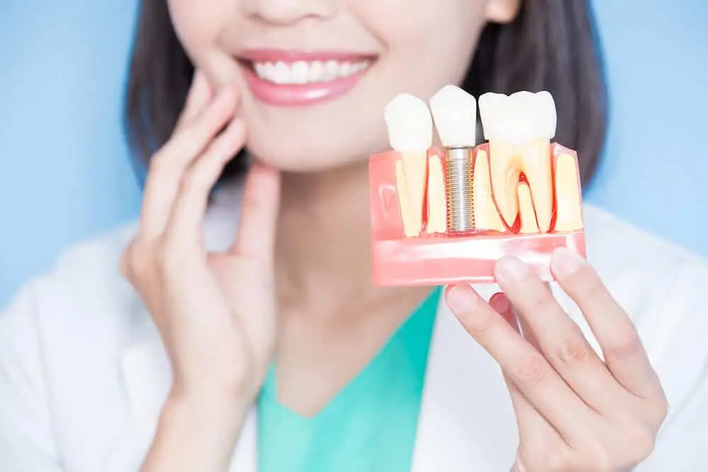 Woman holding model of implant and tooth with hand on jaw.