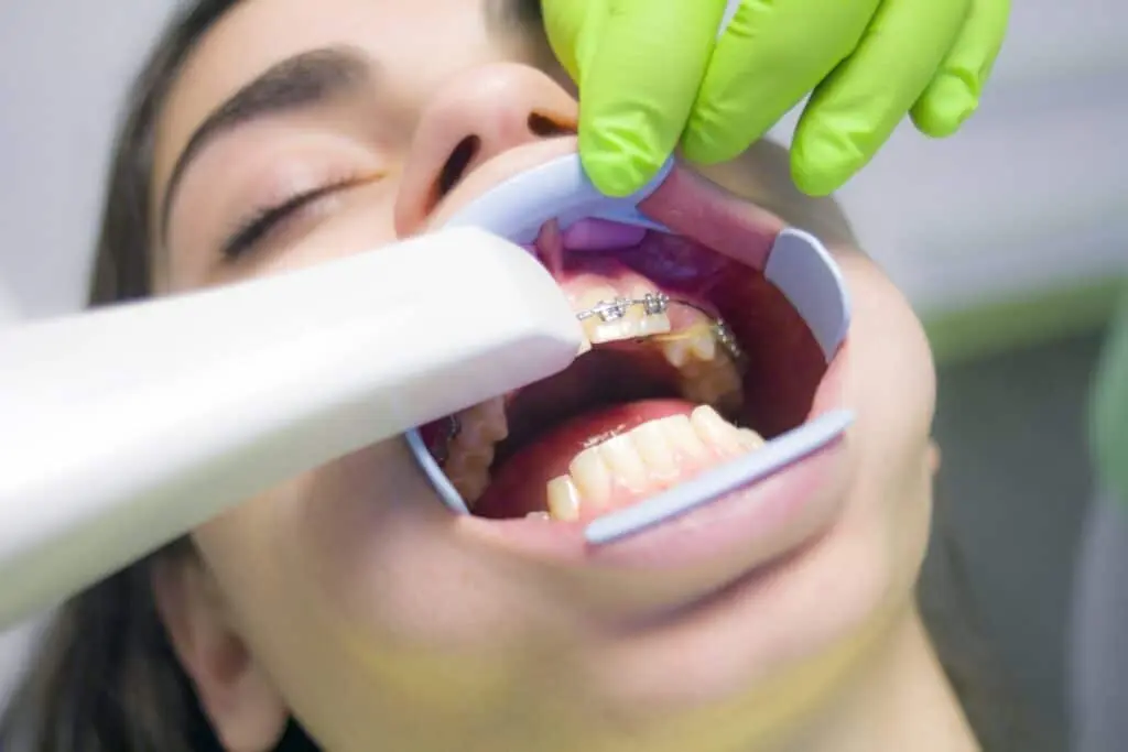 dry mouth treatment 1 1024x683 1