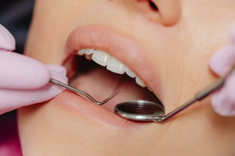 Tooth fillings – Types, materials, and possible problems 2 Dental mirror reflecting image of clean lower teeth during check-up.