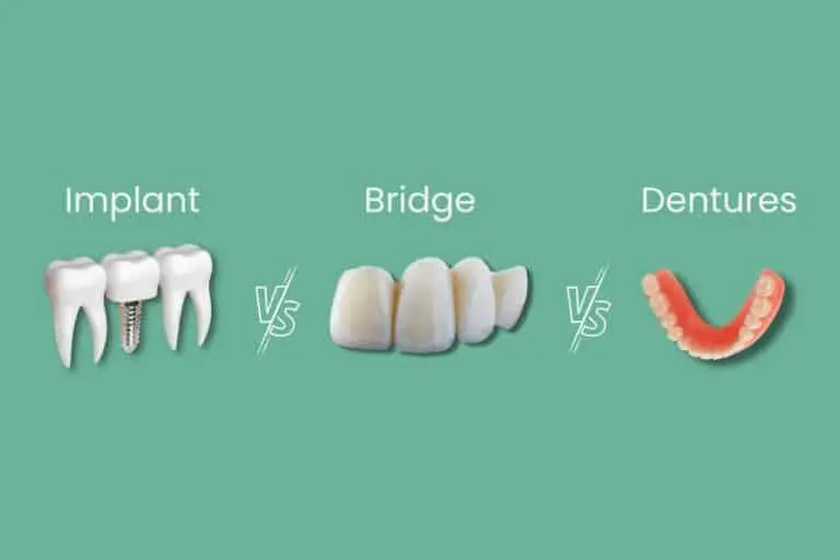 Graphic showing implant, bridge, and denture as tooth replacement options.