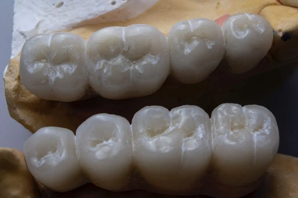 Bad breath after wisdom teeth removal: what to do 2 bad breath after wisdom teeth removal