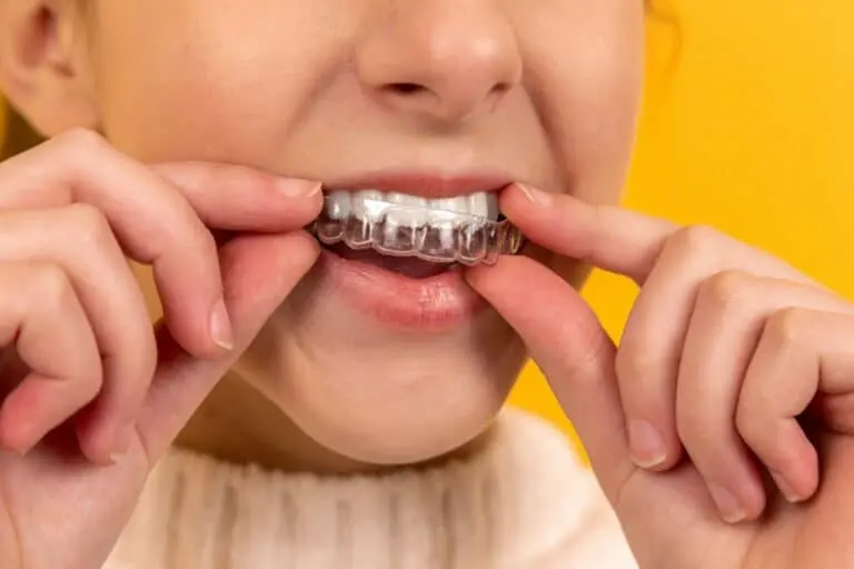 Guide to TMJ Splints 1 Person inserting clear aligner with both hands against yellow background.