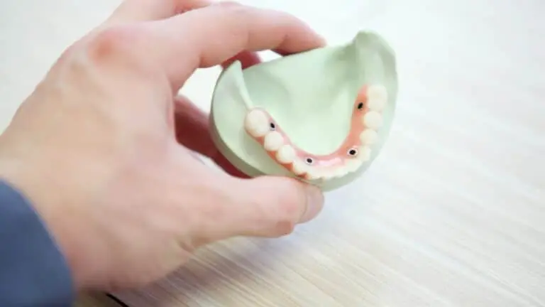 My Dental Filling Fell Out 2 Hand holding dental mold with partial denture attached.