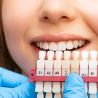 Home 2 A person smiles while holding a veneer shade guide used for comparing teeth shades.