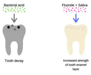 Tooth Sensitivity