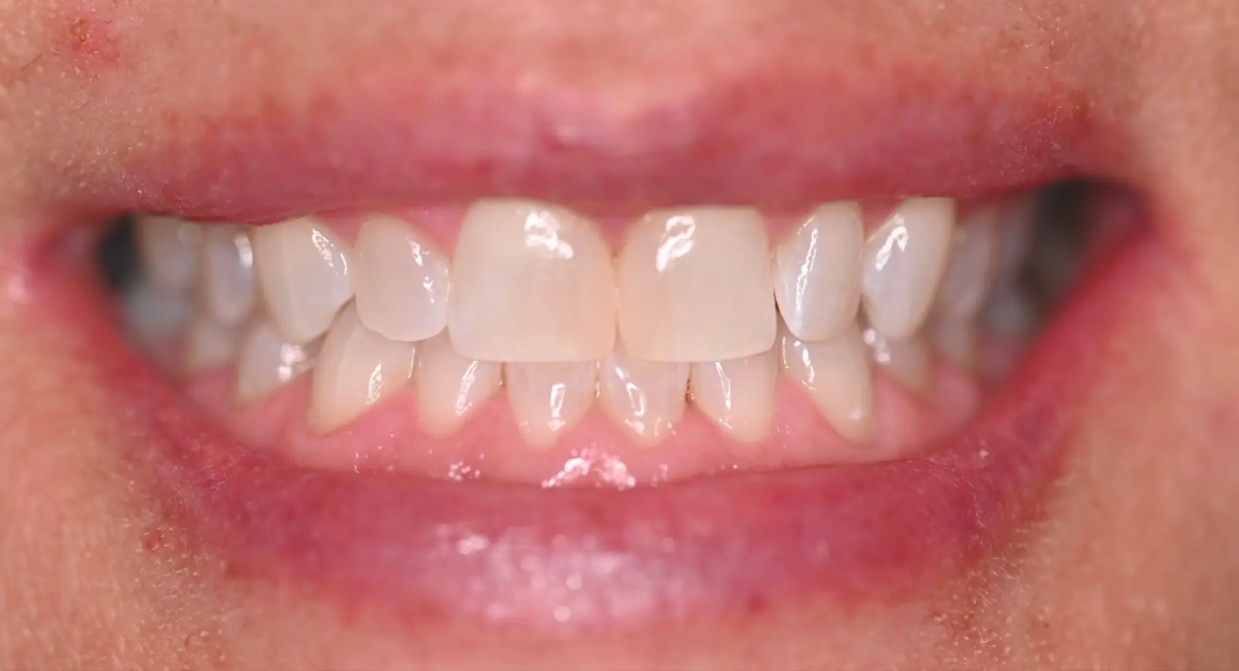 VP Dental | Smile Gallery