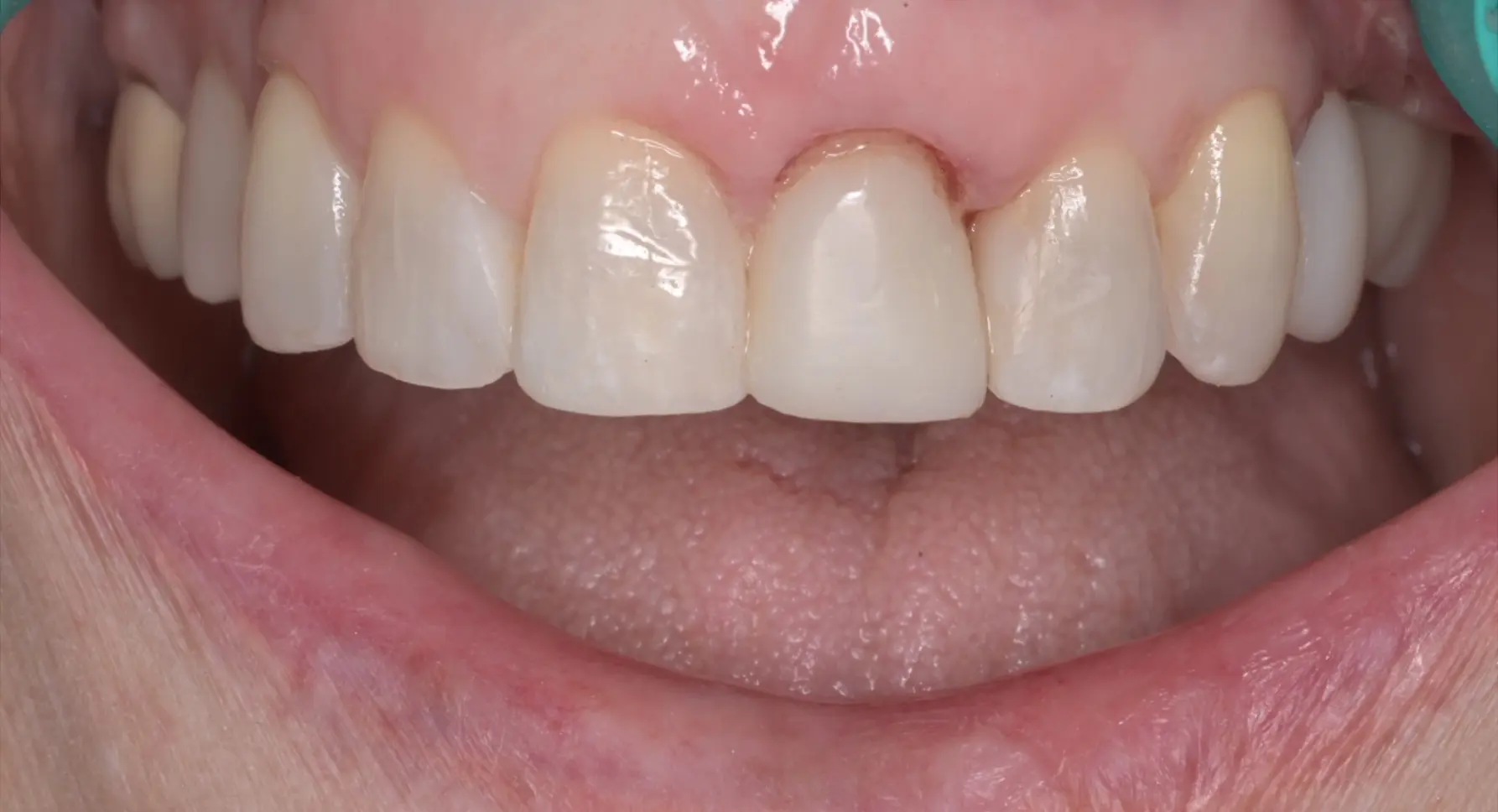 VP Dental | Smile Gallery