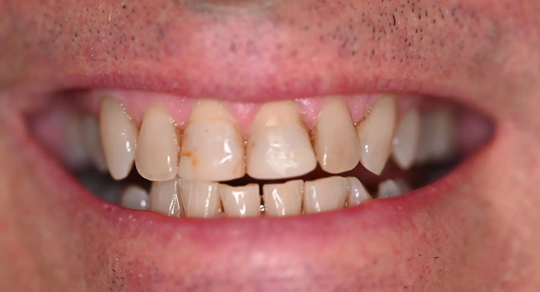 VP Dental | Smile Gallery