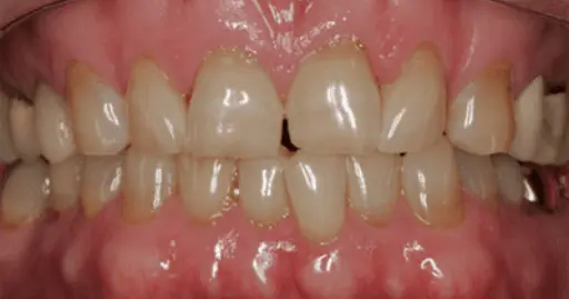 VP Dental | Smile Gallery