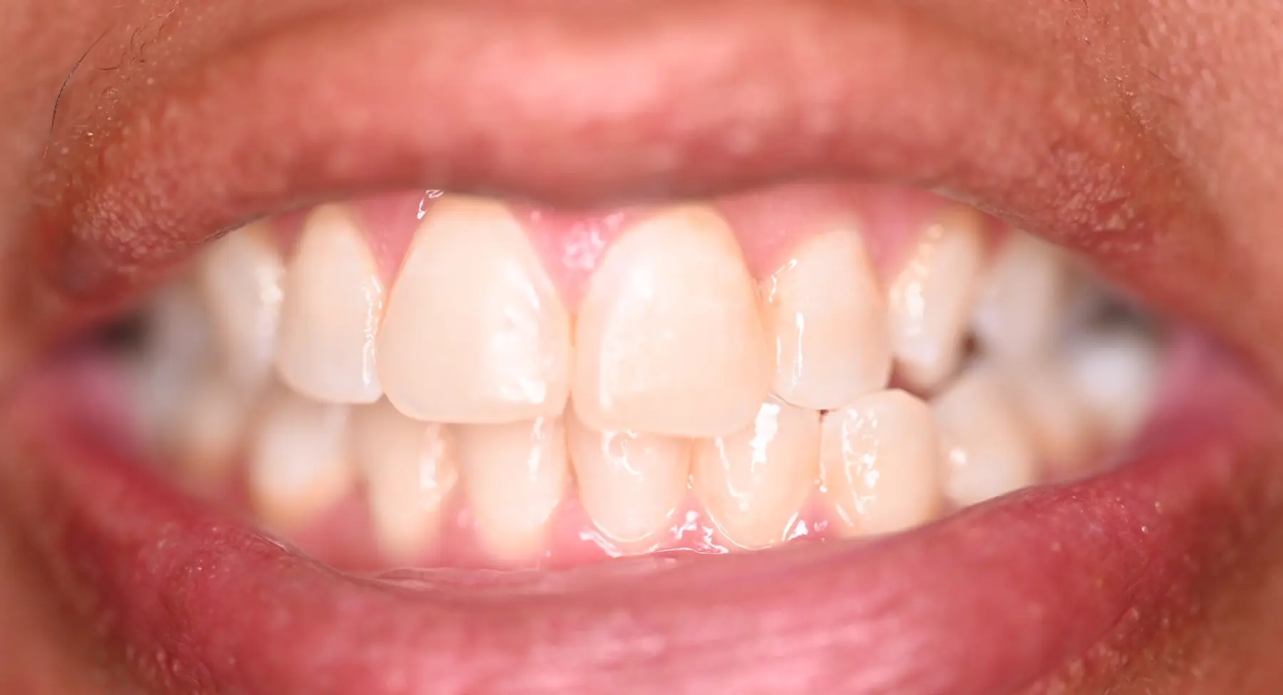 VP Dental | Smile Gallery