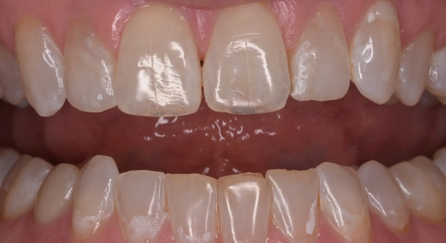 VP Dental | Smile Gallery