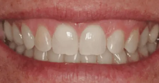 VP Dental | Smile Gallery