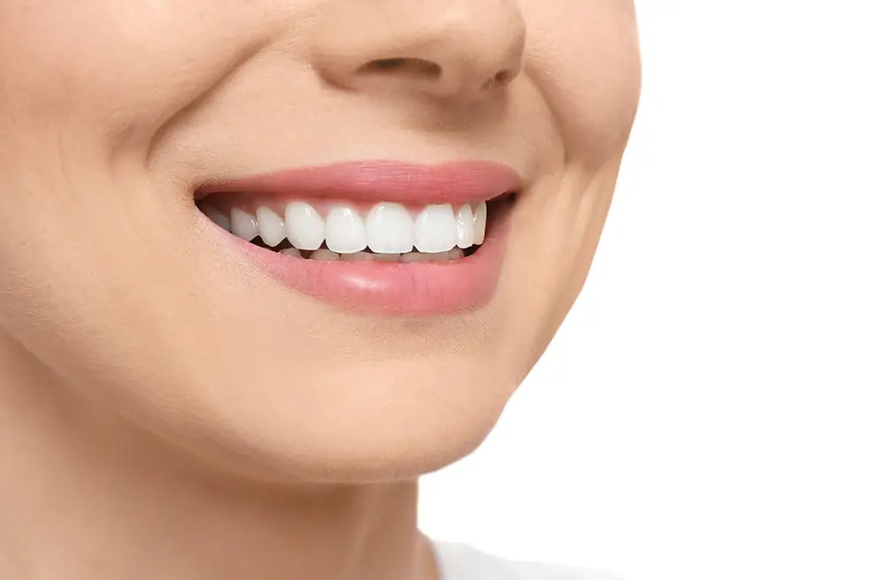 Close-up of a woman's bright, white smile, representing results from teeth whitening in Raleigh, NC