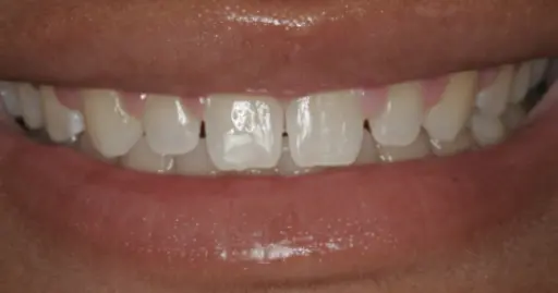 VP Dental | Smile Gallery