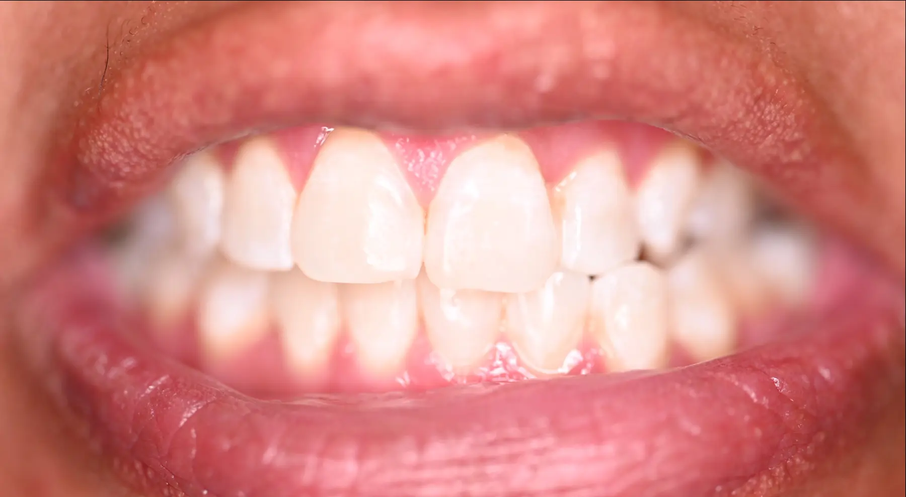 VP Dental | Smile Gallery