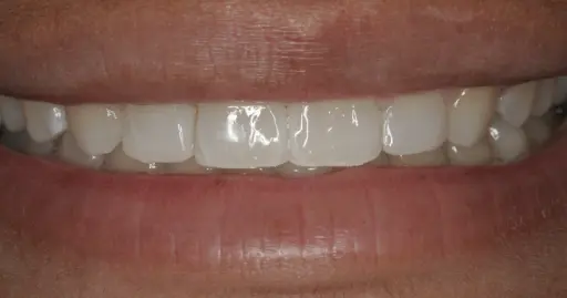 VP Dental | Smile Gallery