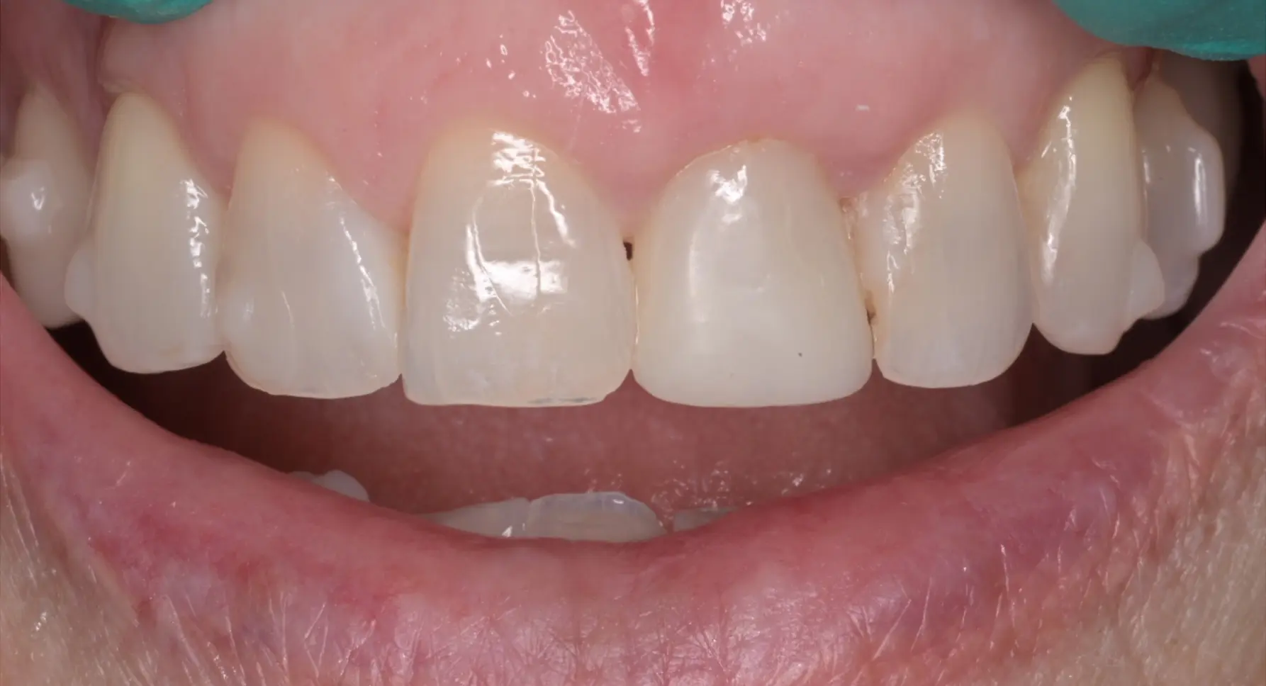 VP Dental | Smile Gallery