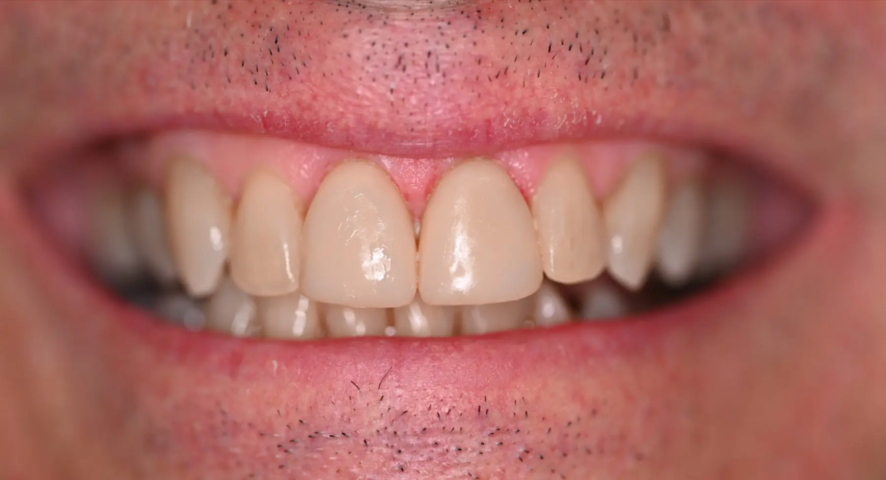 VP Dental | Smile Gallery