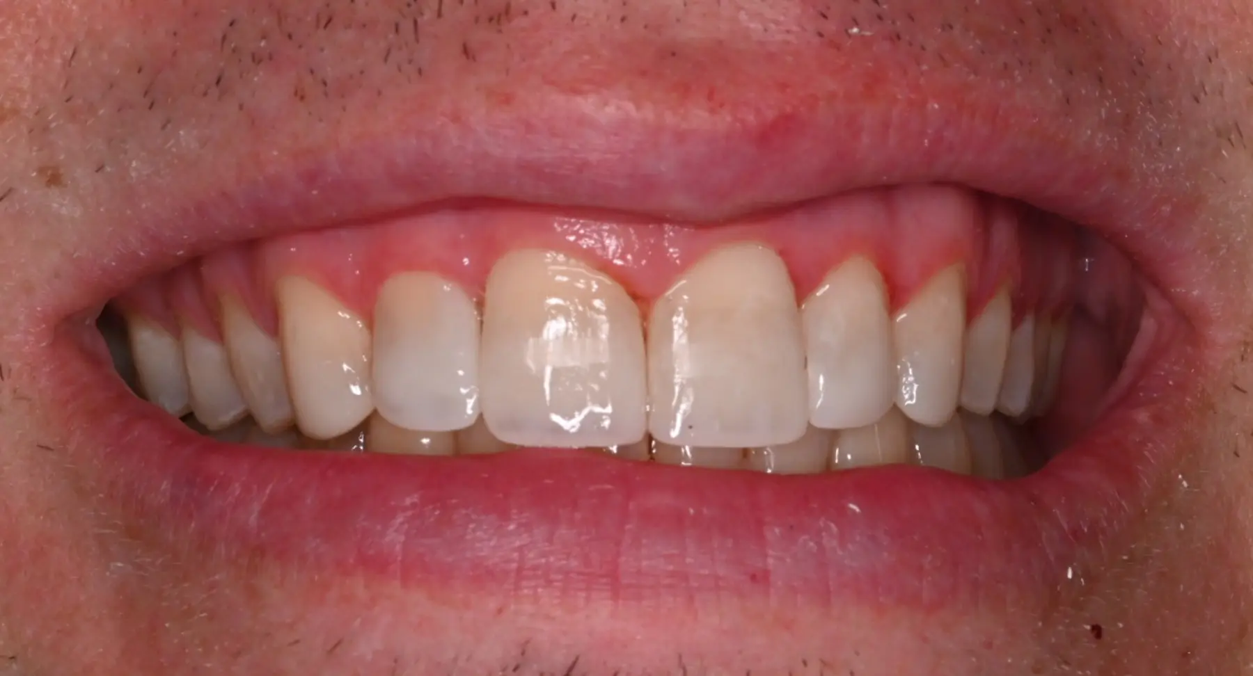 VP Dental | Smile Gallery