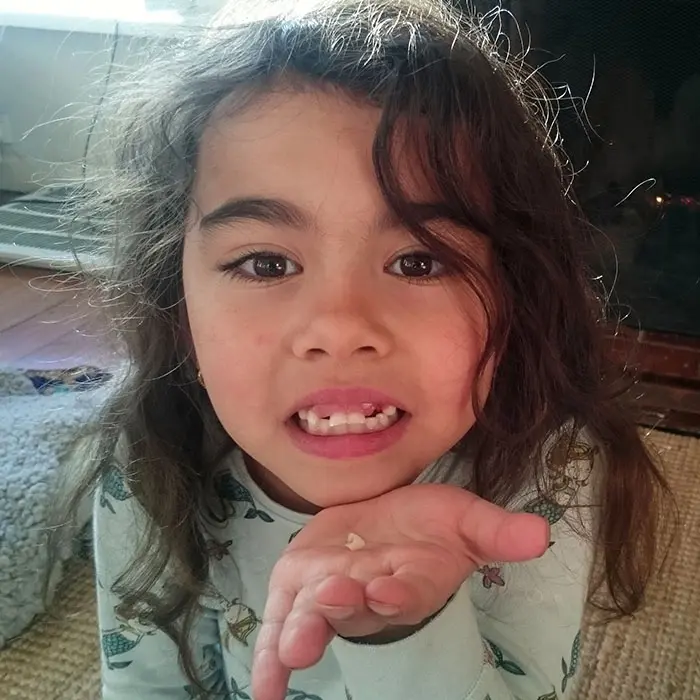What’s Your Plan for the First Loose Tooth? | VP Dental | Stop Chewing Ice VP Dental | Stop Chewing Ice