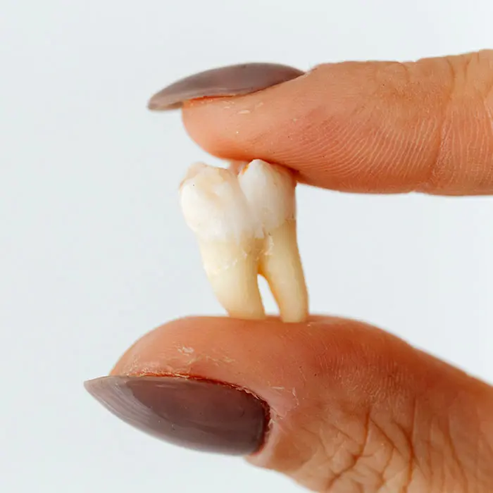 Baby Teeth Traditions of the World | VP Dental | Stop Chewing Ice VP Dental | Stop Chewing Ice