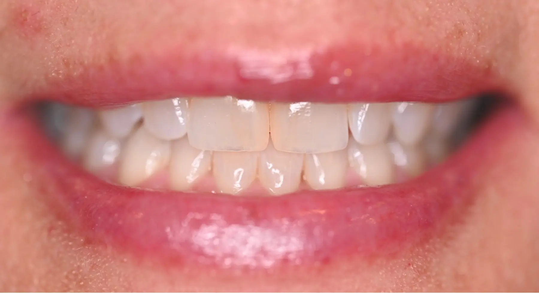 VP Dental | Smile Gallery