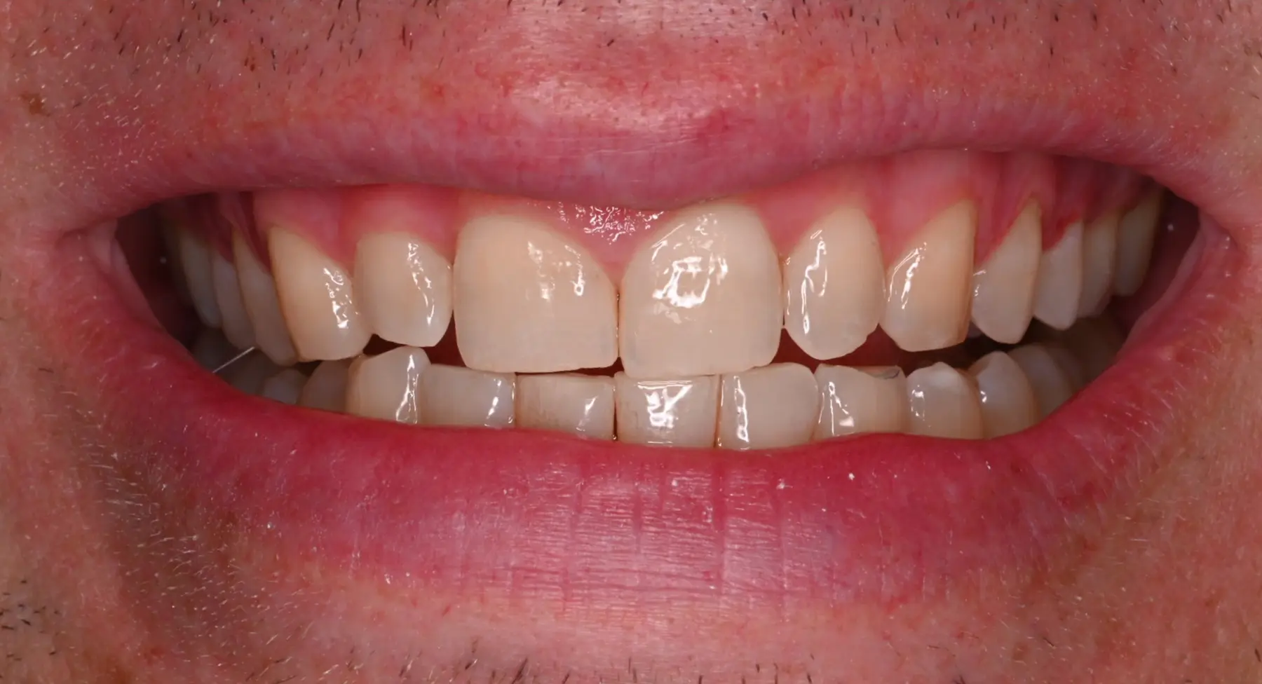 VP Dental | Smile Gallery