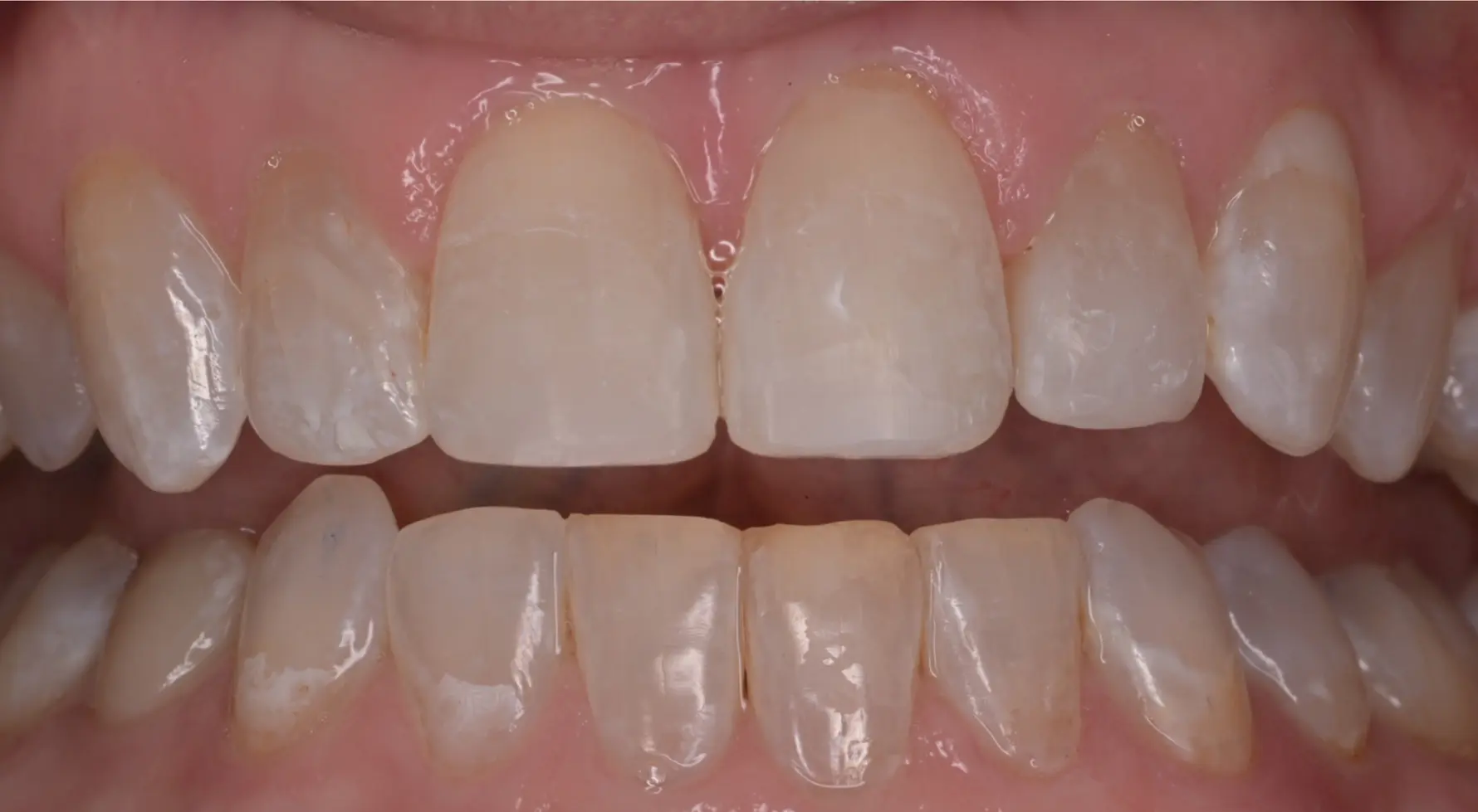 VP Dental | Smile Gallery