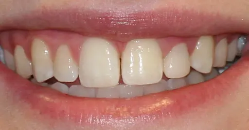 VP Dental | Smile Gallery
