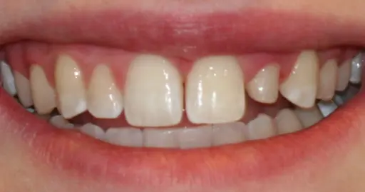 VP Dental | Smile Gallery