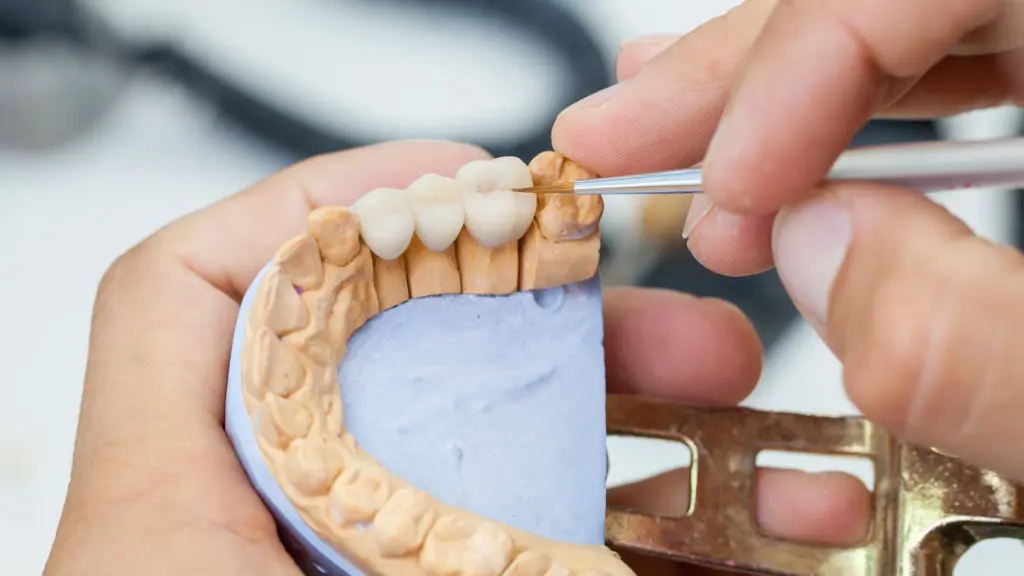 Technician creating a dental bridge