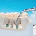 missing tooth
