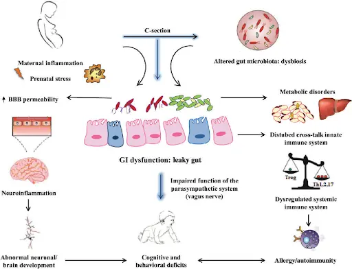 The impact of C-section Delivery on Childhood Health
