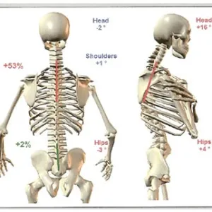 How can you determine if you have poor posture?
