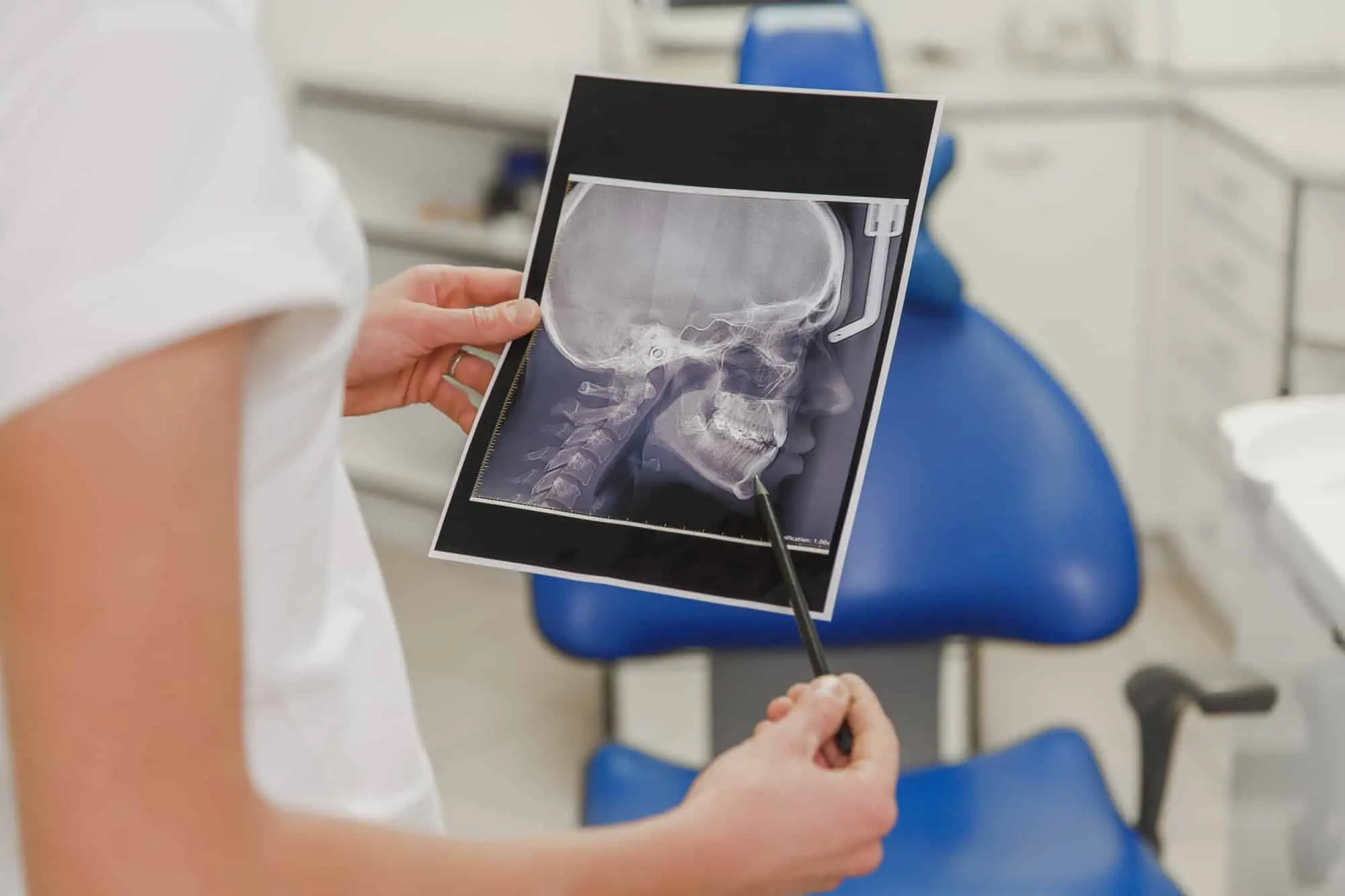 The female dentist holds an X-ray photo of a human skull from a profile in the dental office