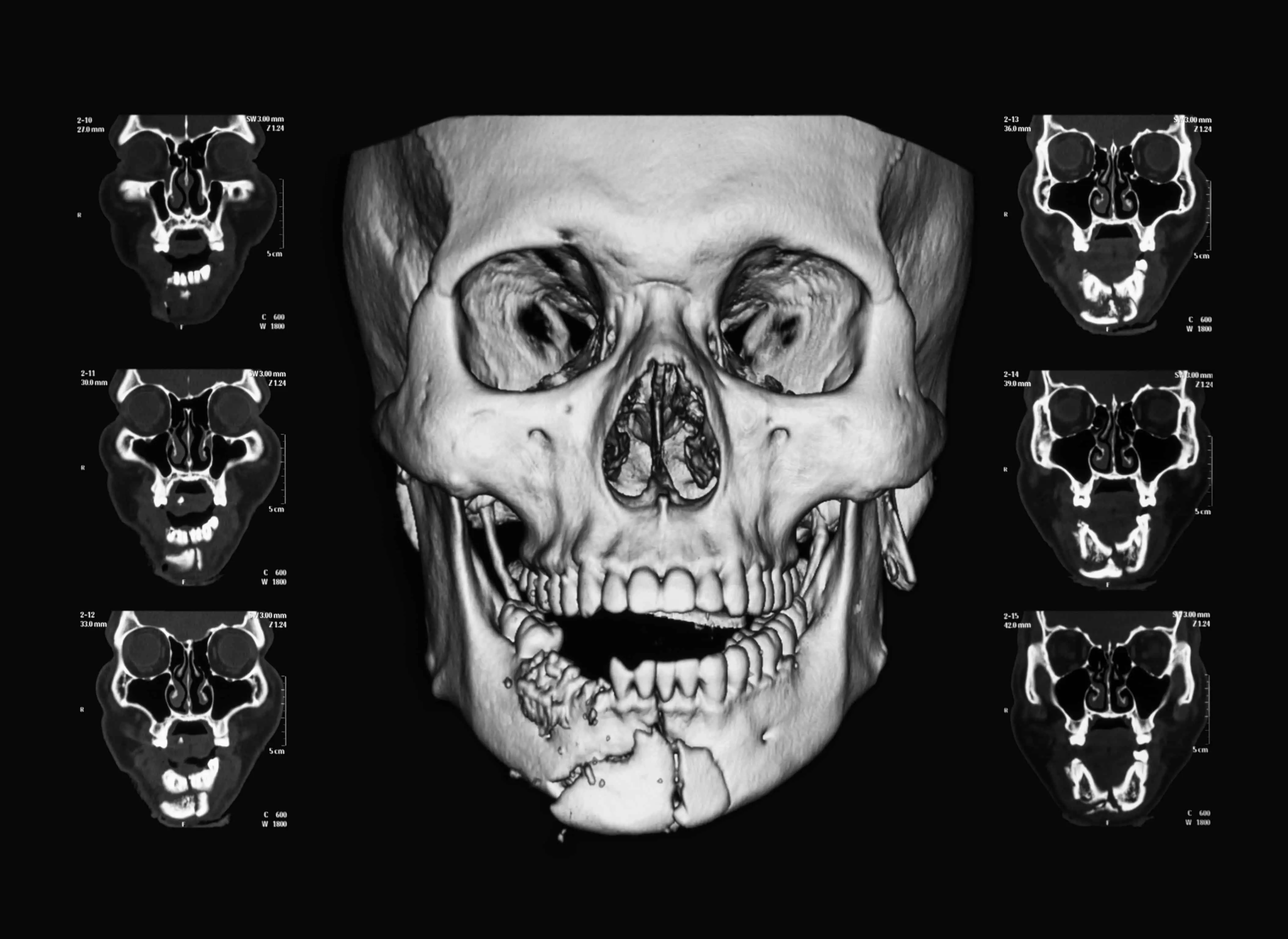 dental intervention after work-related facial trauma