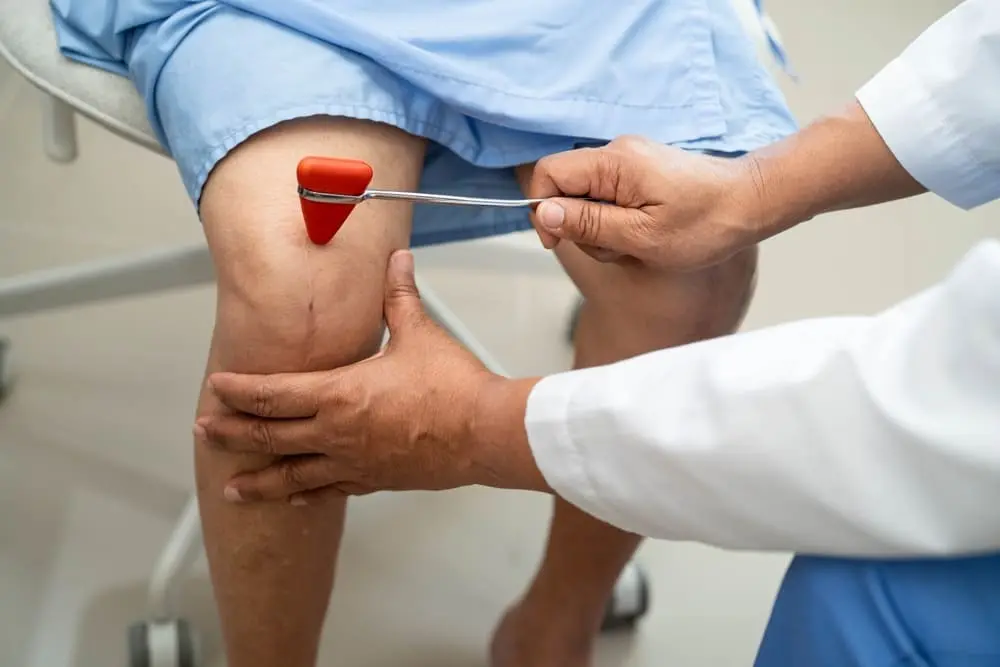 Knee Arthroplasty - New York Spine Surgery