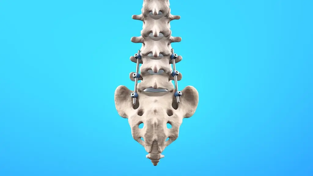 AdobeStock 706607098 - New York Spine Surgery