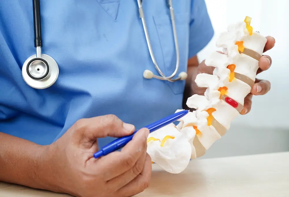Cómo curar rápidamente una hernia discal: Ideas de un especialista de la columna vertebral