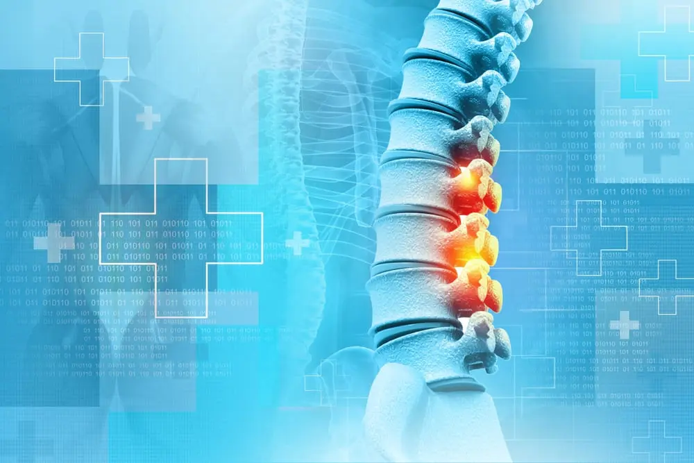 Workplace Spinal Injury