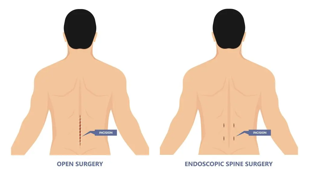 AdobeStock 390144084 - New York Spine Surgery