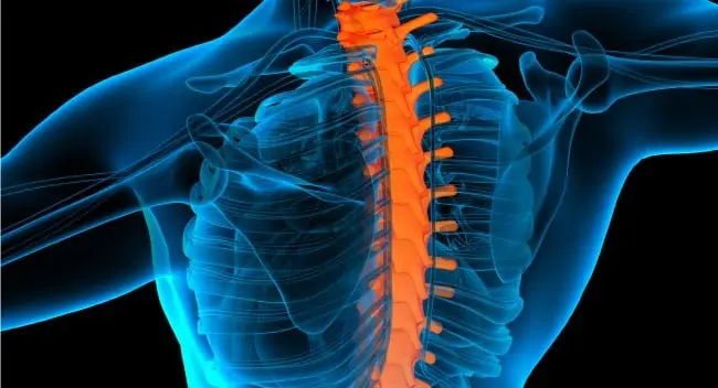 cuello rígido