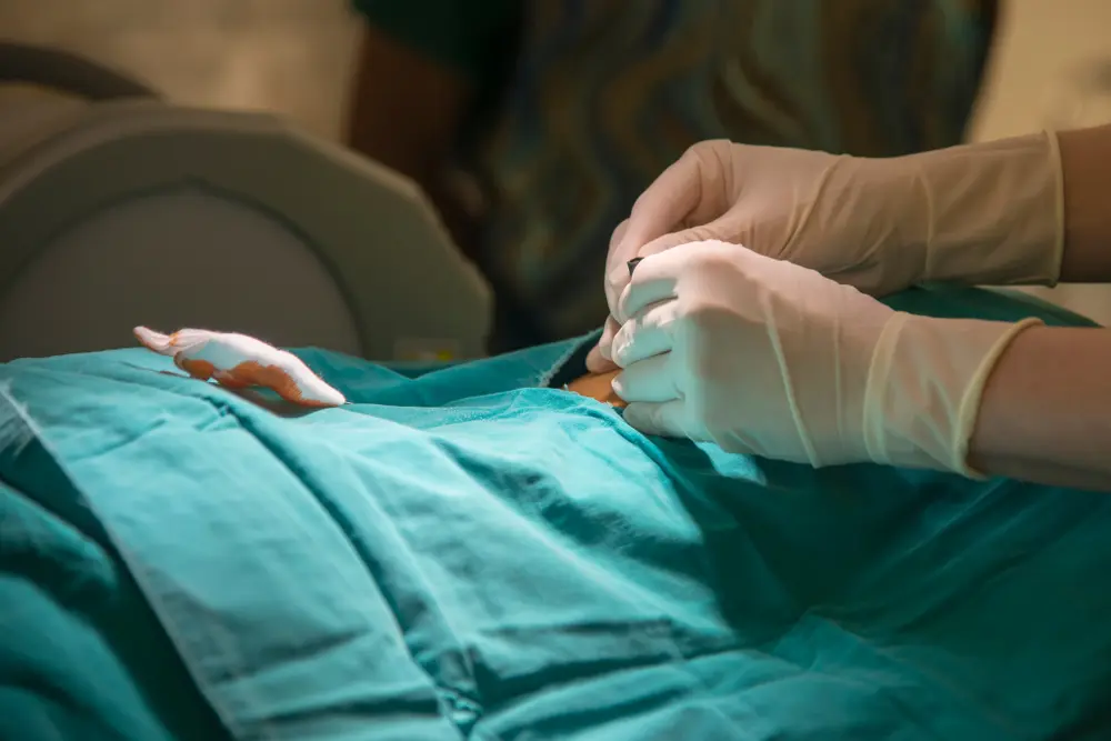 Lumbar Epidural Steroid Injection